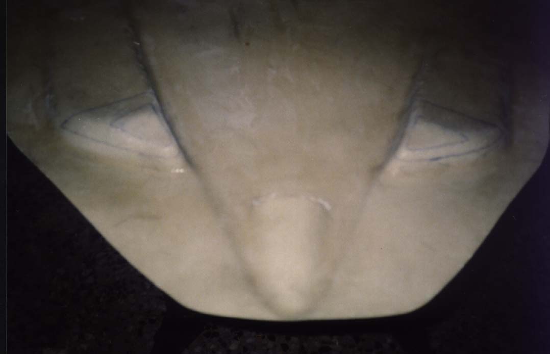  Telefono alarma 100.jpg